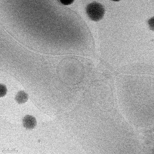 小鼠神经元轴突的低温透射电镜成像--中国科学院生物物理研究所蛋白质 